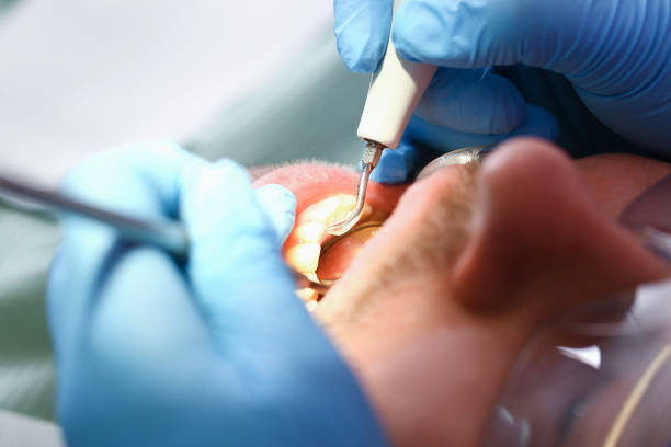 Best Emergency Tooth Extraction  in Bertsch Oceanview, CA