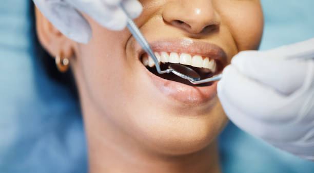 Best Emergency Gum Pain Relief  in Bertsch Oceanview, CA