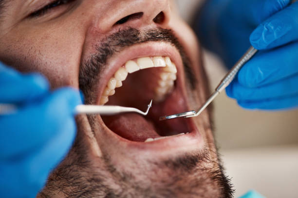Best Emergency Gum Pain Relief  in Bertsch Oceanview, CA