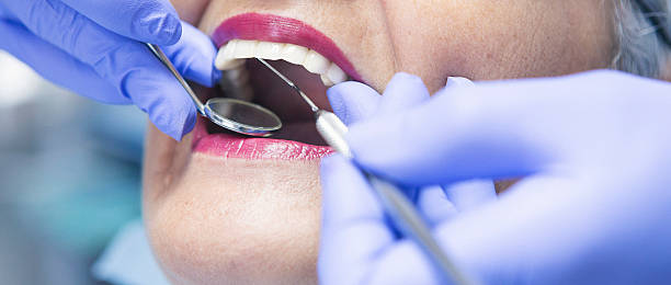 Best Knocked-Out Tooth Emergency  in Bertsch Oceanview, CA